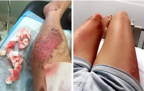Туристы пострадали на Бали