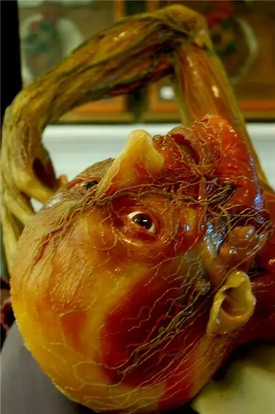 Медицинский музей Джозефинум