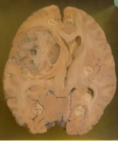 Музей болезней человека