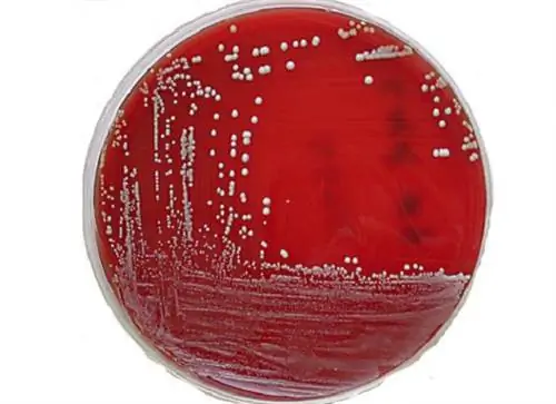 Грязные тайны отелей