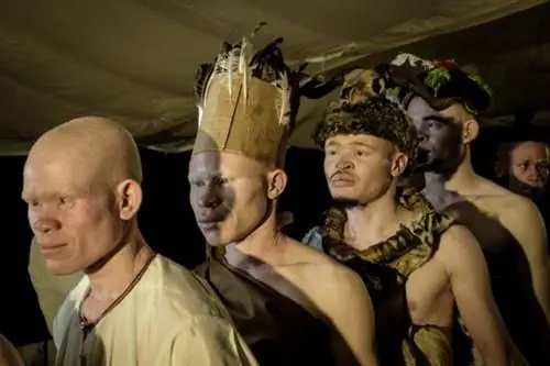 Кенийский конкурс красоты способствует уверенности в себе у людей с альбинизмом