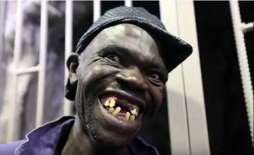 Зимбабве: этот 42-летний безработный выиграл конкурс на звание самого уродливого мужчины страны