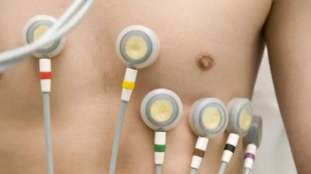 Вредны ли тренировки на выносливость для вашего сердца?