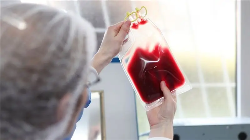 Могут ли марафоны вызвать отравление крови?