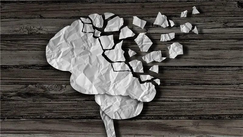 Как лечить сотрясение мозга