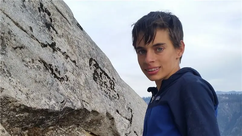 Этот 15-летний подросток только что залез по носу