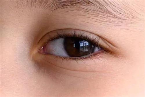 Глаз при 100% увеличении