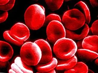 Дезоксированная кровь превращается в темно-красный, не голубой