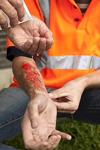 Белки яиц не делают хорошую процедуру ожога