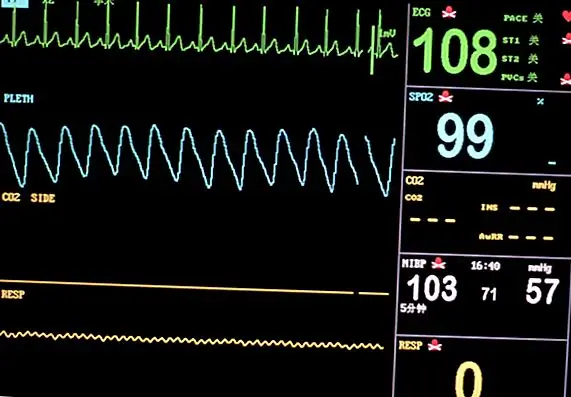 Голливудские медицинские мифы Часть 1: шокирующий кого-то, у кого есть «плоская подкладка», может вернуть свое сердце снова