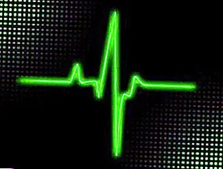 Как читать ЭКГ (электрокардиограф)