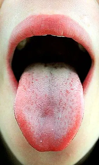 Как рассказать, являетесь ли вы супермастером