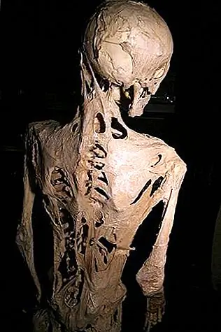 Возможно, что мышцы человека и другие соединительные мягкие ткани превратятся в кость