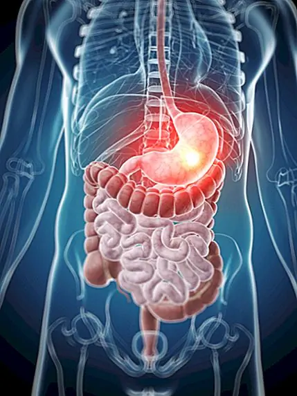Лауреат Нобелевской премии Барри Дж. Маршалл в части доказал, что вызывает язвы, забивая бактерии, которые он думал, причинял им