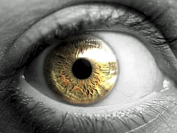 Видение мира в черно-белом: Achromatopsia