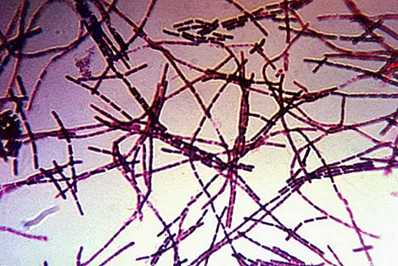 Британский план по охвату Германии с помощью сибирской язвы