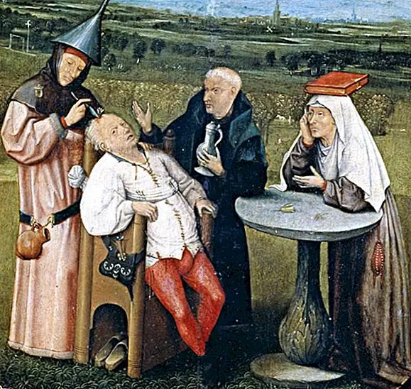 Любопытная практика Trepanning