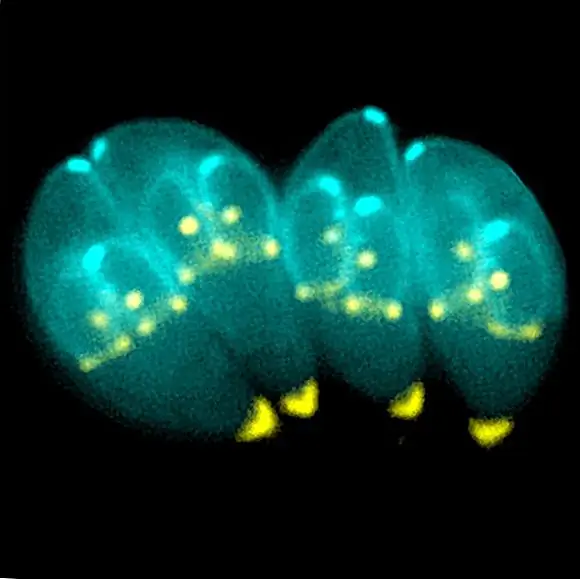 Паразит, который мог бы жить внутри вас прямо сейчас, Toxoplasma Gondii