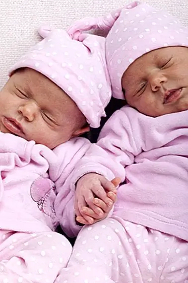 Близнецы, родившиеся 87 дней