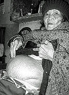 Женщина, которая перенесла плод в своем теле на 60 лет