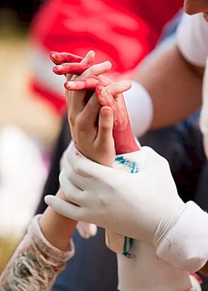 Лучшие 5 советов по оказанию первой помощи, которые каждый должен знать, часть 1: прямое давление