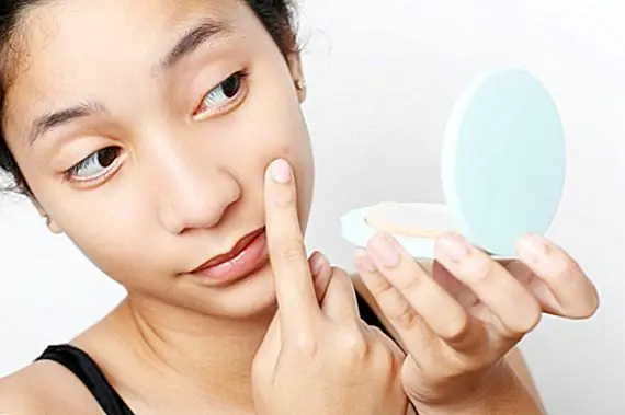 Что вызывает акне