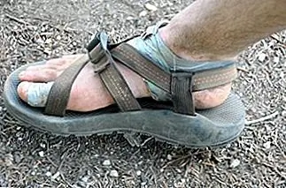 Что вызывает волдыри