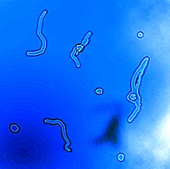 Что вызывает «плавающие глаза»