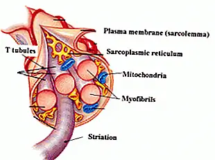 Что вызывает болезненность мышц после тренировки (Примечание: это не молочная кислота)