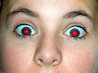 Что вызывает красные глаза в фотографиях