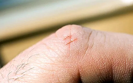 Почему бумажные отрубы сильно вредят