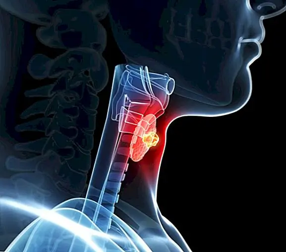 Почему так много проблем со здоровьем от проблем в щитовидной железе