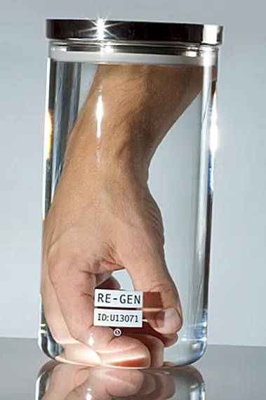 Будут ли больницы возвращать ампутированную конечность, если вы попросите об этом?