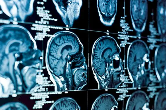 Вы на самом деле используете весь свой мозг, а не 10%