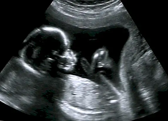 От жидкости к воздуху: почему вы не умирали при рождении