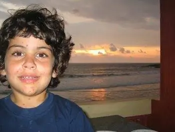 Аида с ветряной оспой. больной