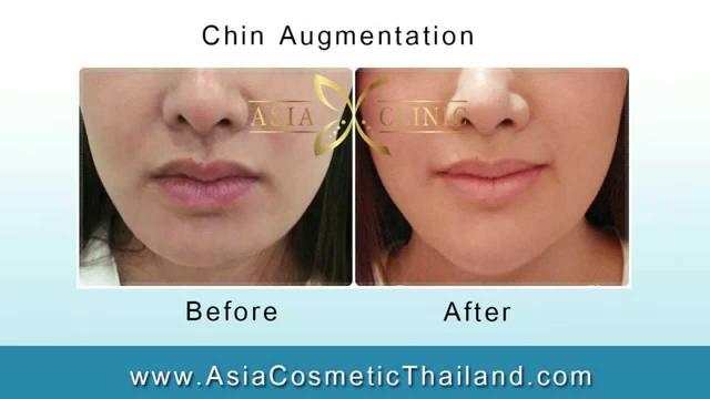 Танонгсак «Дтонг» Йордваи Бангкок