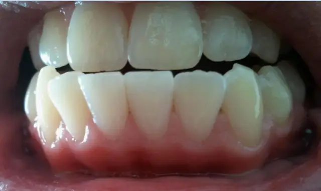 Что заставляет детектор CO сработать?