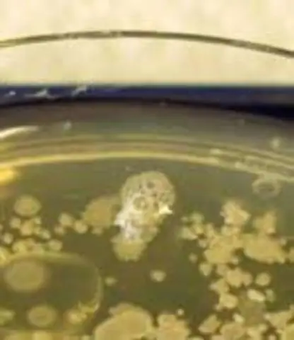 Какие бактерии являются каталазо-положительными и оксидазно-отрицательными?