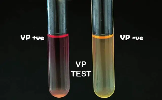 Положительна ли оксидаза Escherichia coli?