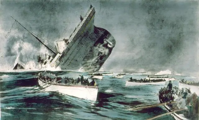 Вы ставите запятую после слова, потому что?