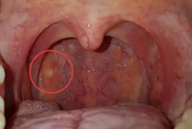Как мне избавиться от баллона времени воздушного шара?