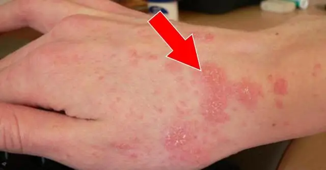 Как разводить семена календулы?