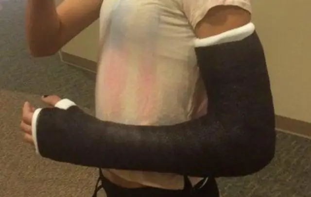 Что такое закрытие двойного условного депонирования?