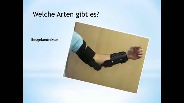 Что такое собственность Macrs?