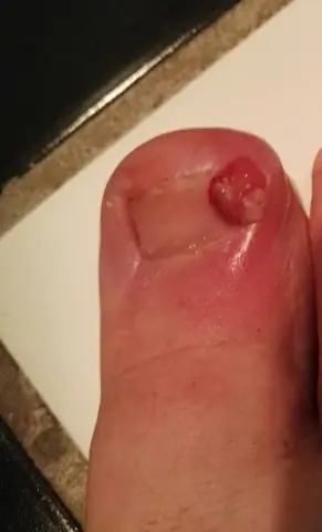 Как мне добавить объявление о моей недвижимости в «nextdoor»?