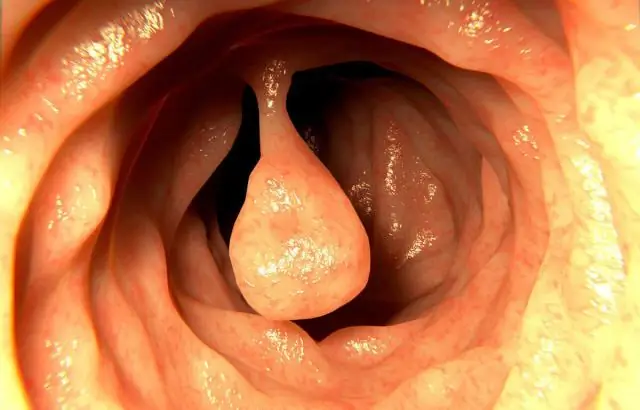 Как должны выглядеть остаточные участки?