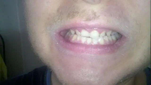 Как должен выглядеть остаточный сюжет?