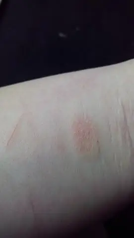 Что не так с моим креп-миртом?