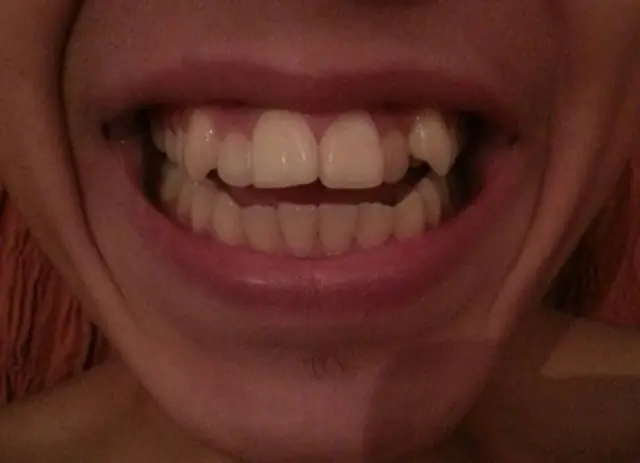 Сколько стоит резиденция Ritz Carlton?